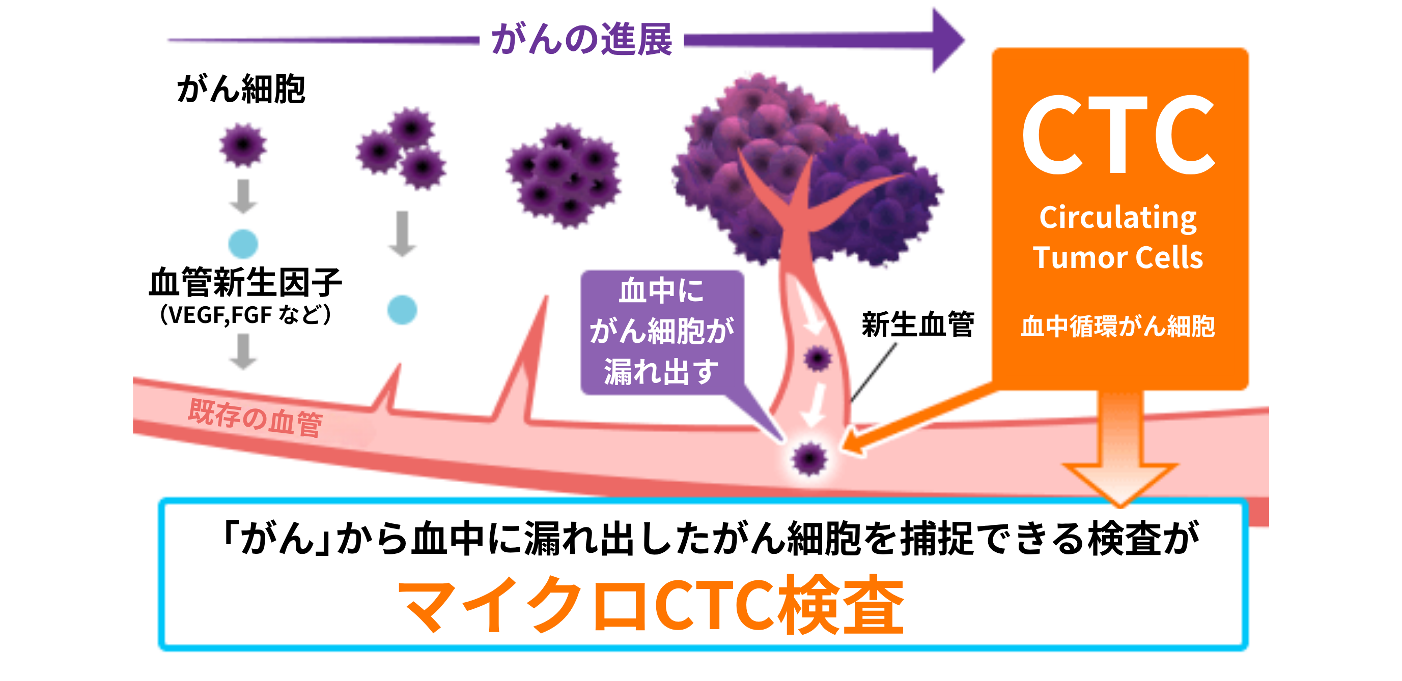 CTCとは