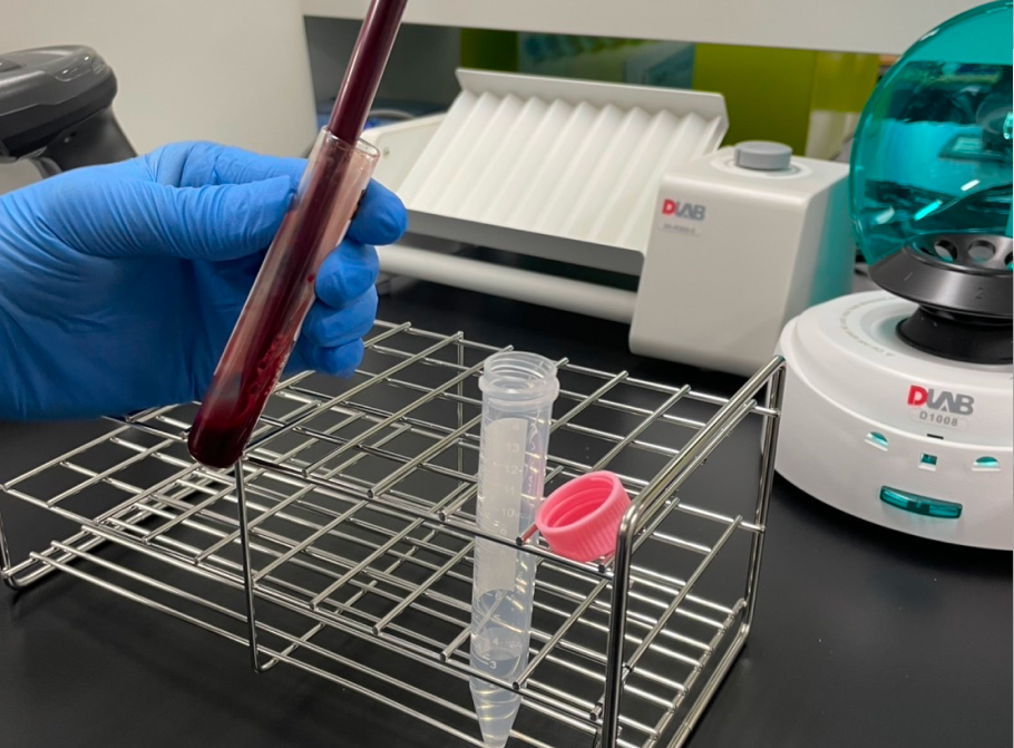 PBMC(末梢血単核細胞)の回収・補足